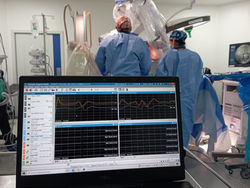 neuromonitoreo intraoperatorio