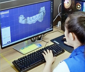 A dental technician at Aceso Dental Lab using advanced CAD software to meticulously design a custom dental restoration based on a patient's 3D scan.