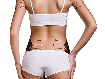 Woman's buttocks prepared to plastic surgery isolated.jpg