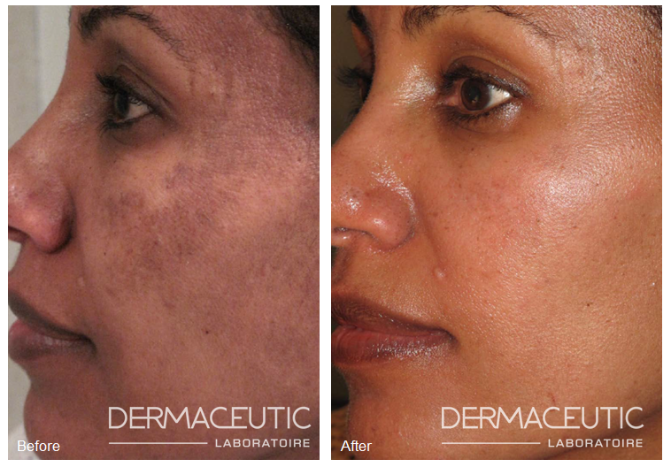 DERMATOLOGICAL INDICATIONS dermaceutic