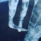 Ice L