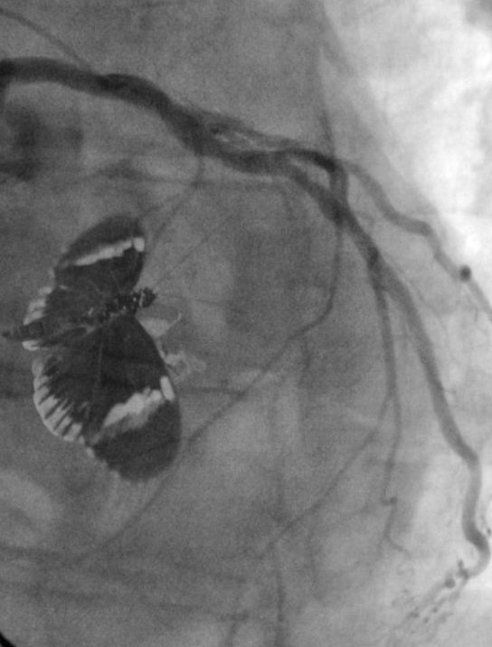 My Hearts a Flutter-banner.jpg