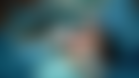 Wisdom Teeth Extraction: A Comprehensive Guide