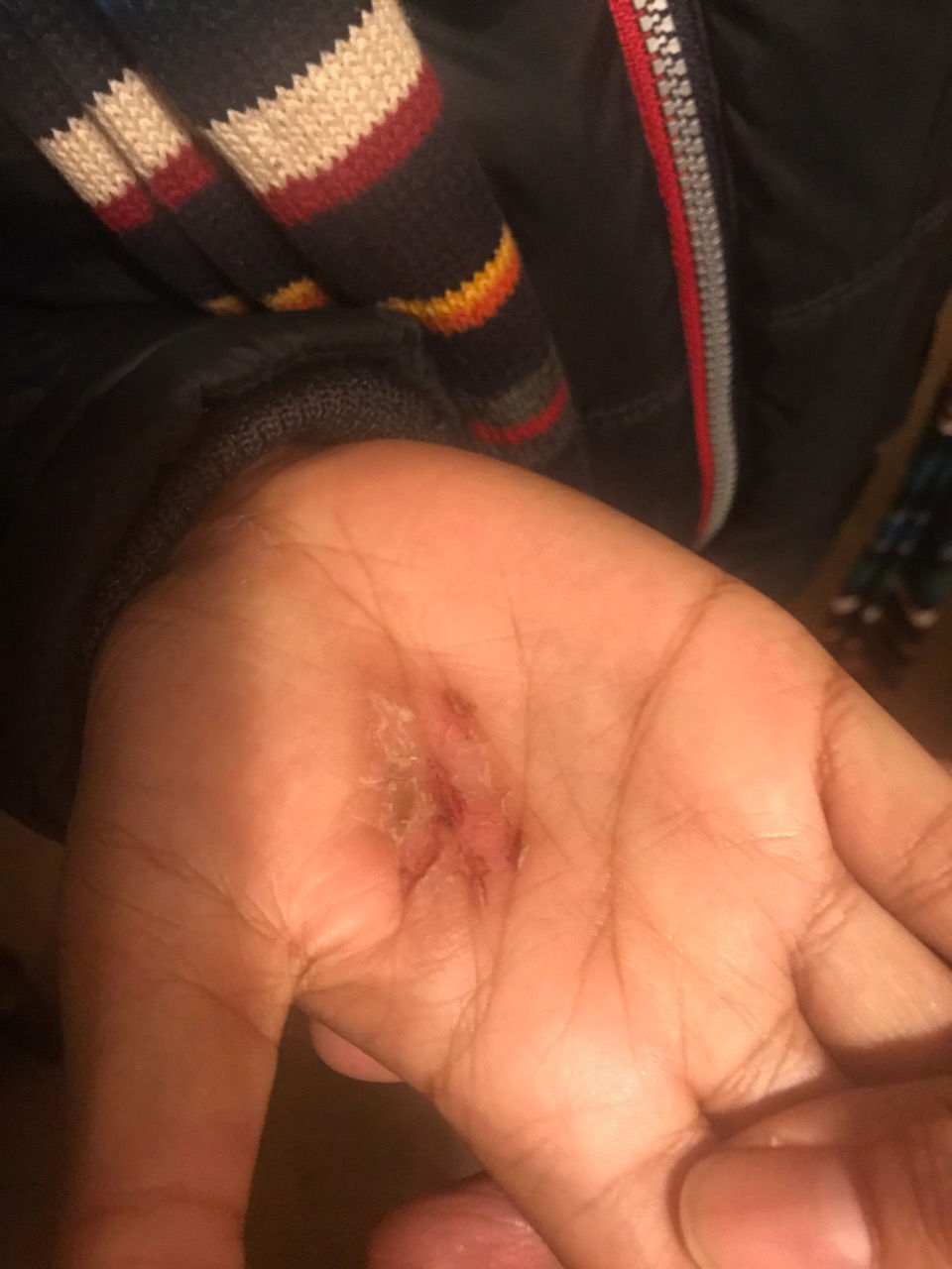 Thumbnail: Antifungal Herbal Salve