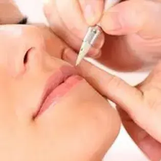 épilation