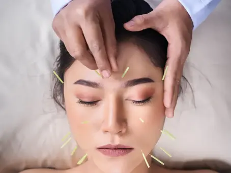 Facial Acupuncture