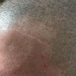 Dr. Andrea echeverry Scar Camouflage Fac