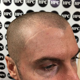 Dr. Andrea echeverry Scar Camouflage Fac