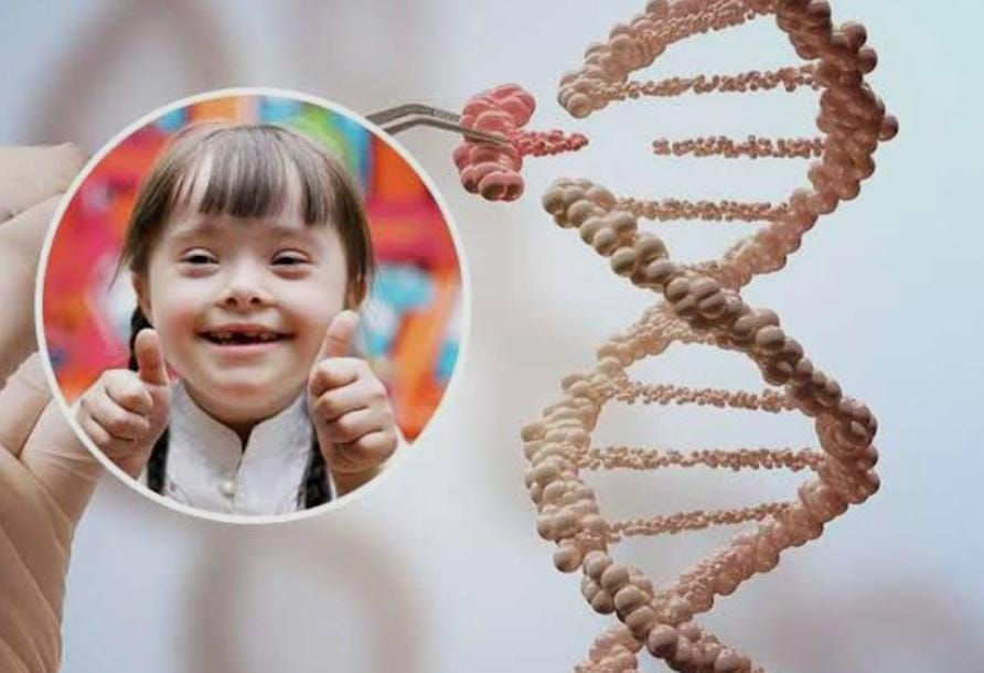 Avance en la Edición Genética para el Síndrome de Down
