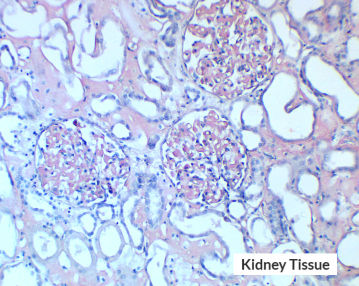 Thumbnail: Amyloid/Congo Red/Crystal violet Control Slides