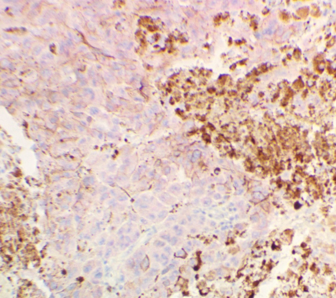 BRAFV600E Control Slides