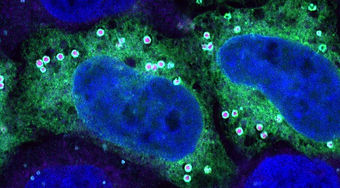 Lipid droplets on cells