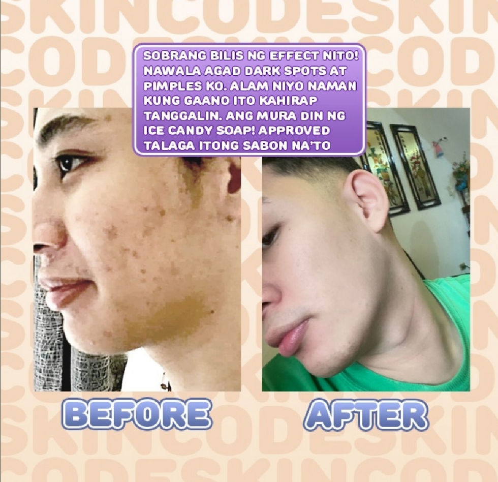 Thumbnail: ICE CANDY WHITENING AND ANTI ACNE SOAP