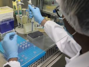 Amazonas registra 228 novos casos de Covid´-19 e 219 da varíola dos macacos, sem óbitos nas últimas