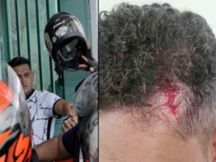 David Almeida divulga nota de repúdio contra motociclistas que agrediram servidores do IMMU