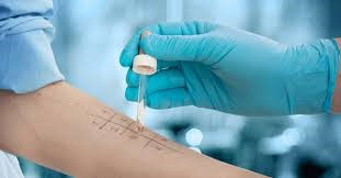 Test Allergie Alimentari