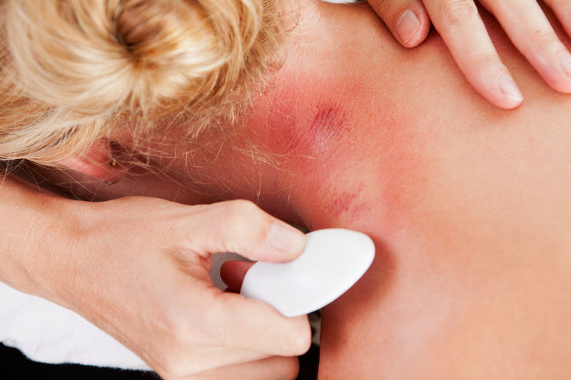 Gua Sha effect