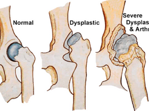 Physiotherapy and hydrotherapy for management of hip dysplasia