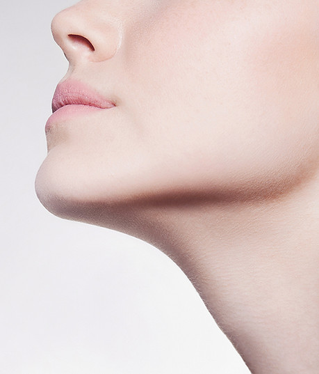 Facelift surgery