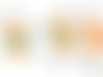 Diagram compares normal joint, osteoarthritis, and rheumatoid arthritis. Labels show bone, synovial fluid, and membrane differences.