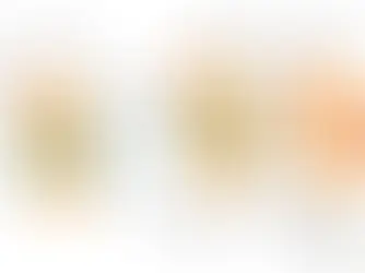 Diagram compares normal joint, osteoarthritis, and rheumatoid arthritis. Labels show bone, synovial fluid, and membrane differences.