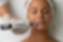 Dermapen 4.jpeg