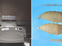 캘리포니아 보건 당국, 인간 공격 희귀 기생충 경고