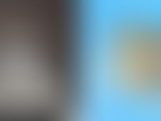 캘리포니아 보건 당국, 인간 공격 희귀 기생충 경고