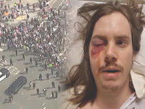 취재 중 고무탄 맞아..경찰 "더 강력 대응"