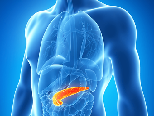 Pancreatitis.png