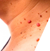 Dermatología Medica 2.png