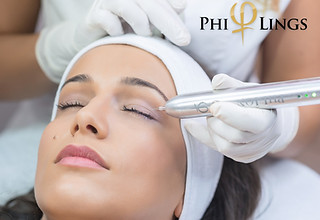 Lifting víček pomocí plazmového pera