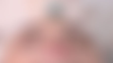 O QUE É DERMAROLLER?