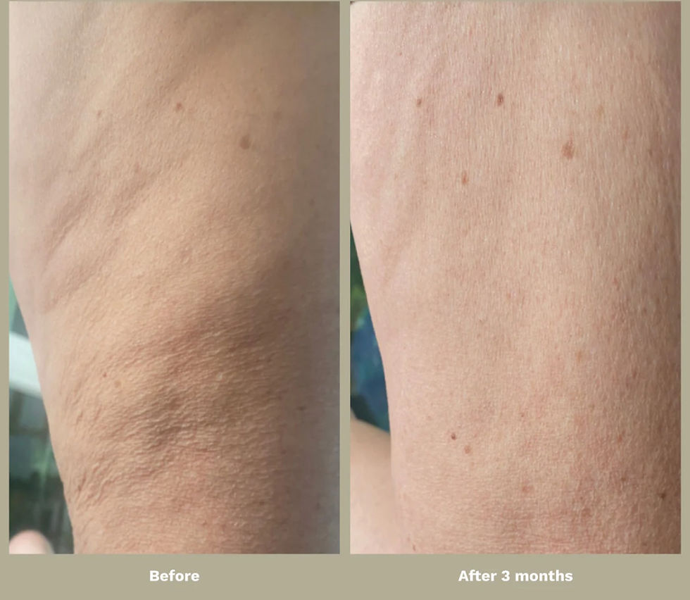 Thumbnail: Adipeau - Strong Body Gel 150 ml / 5.0 fl oz.