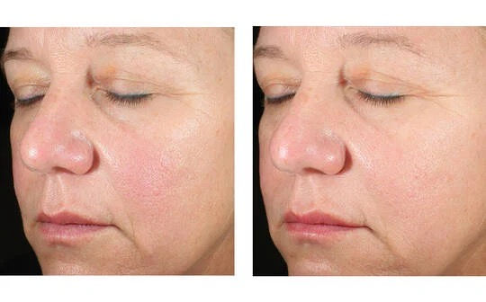 Thumbnail: Alto Advanced Defense and Repair Serum 30 ml