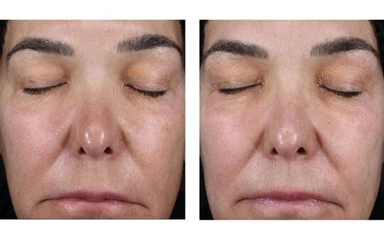 Thumbnail: Alto Advanced Defense and Repair Serum 50 ml