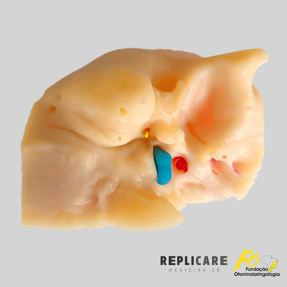Miniatura: AURIS-OTOBONE