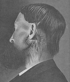 paciente con sarcoma.jpg