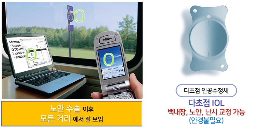 다초점.png