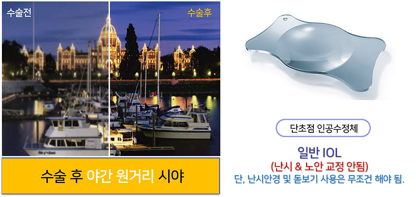 단초첨.png