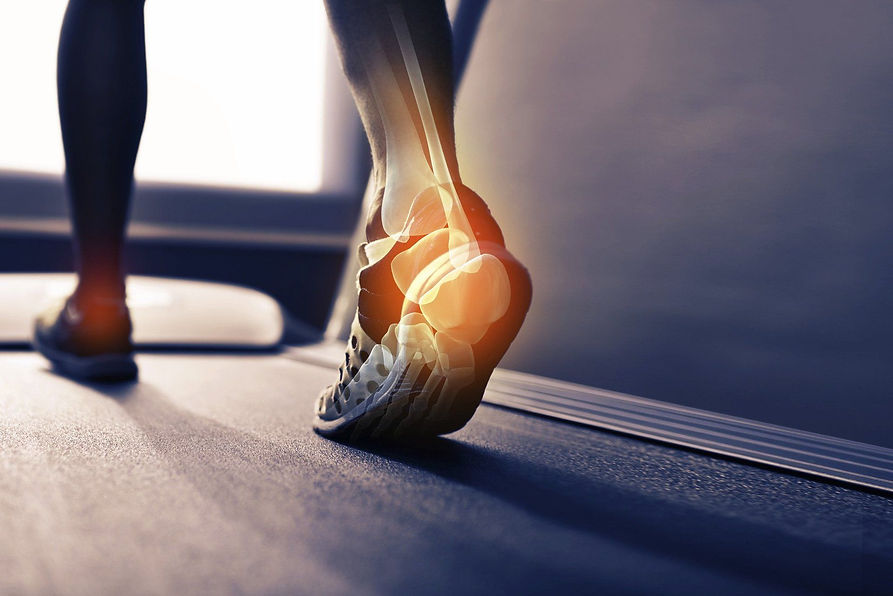 A person walking on a treadmill with a highlighted foot and ankle showing bones and joints