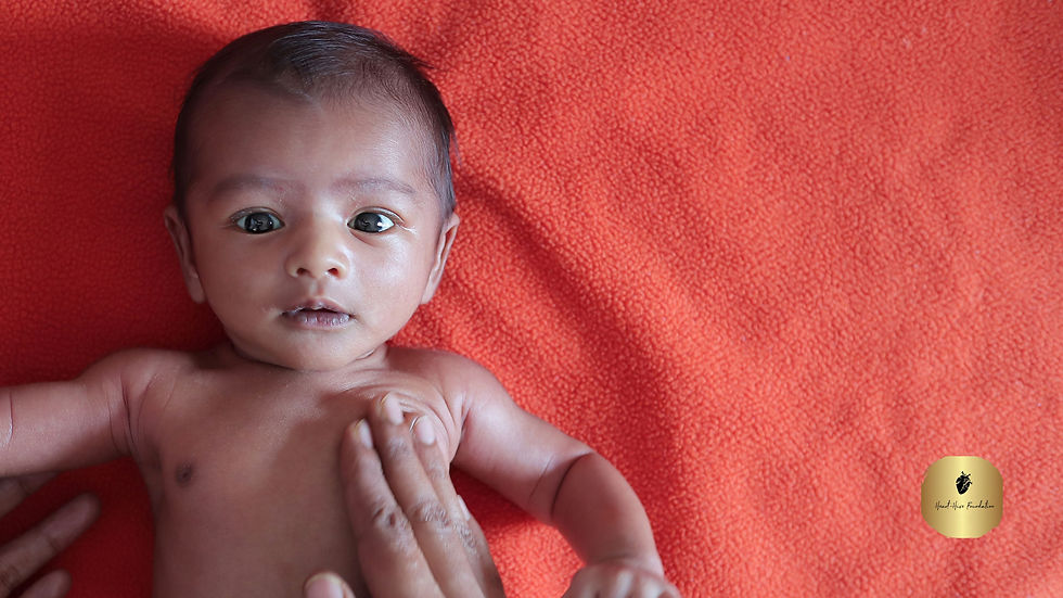 Malnourished child lying on an orange velvet bedding.