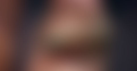 I gechi: infestanti oppure alleati per una lotta biologica?