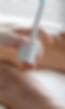 Laser Treatment