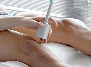 Laser Treatment