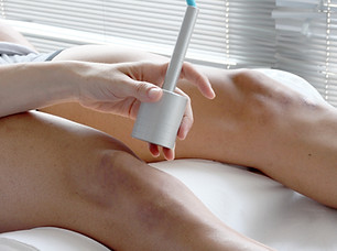 Laser Treatment