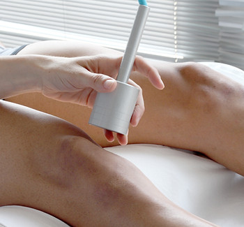 Trattamento laser