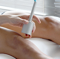 Laser Treatment