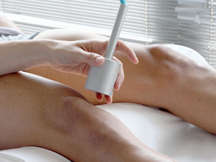 Shock Wave Therapy, Extracorporeal Shock Wave therapy (ESWT)