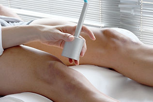 Laser Treatment